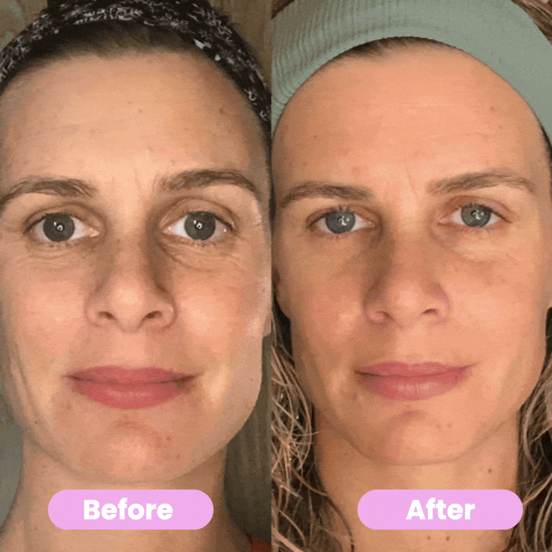 Masseur Visage Anti-Âge